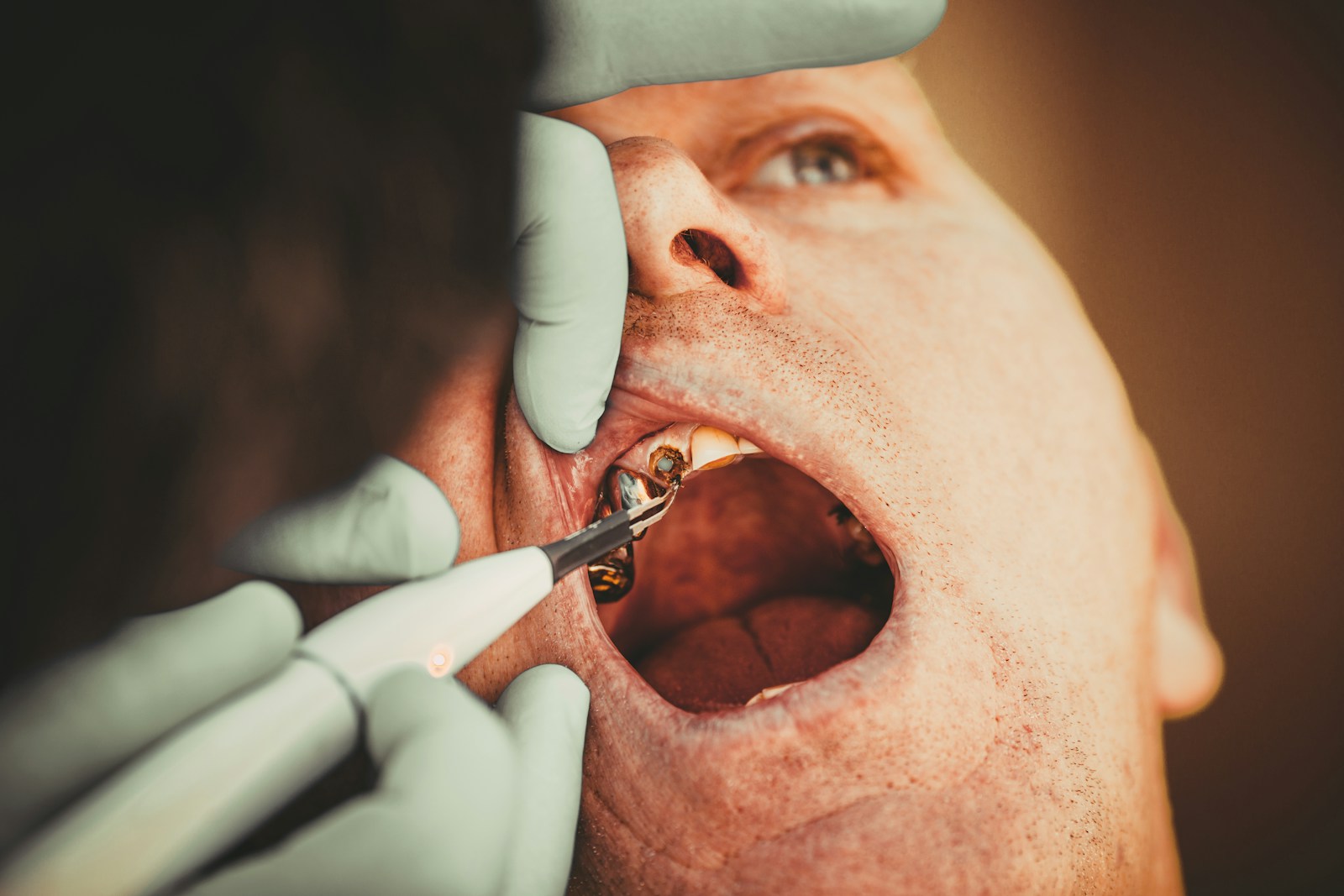 3 Preventive Services That General Dentists Provide To Seniors a man with a mask on his face