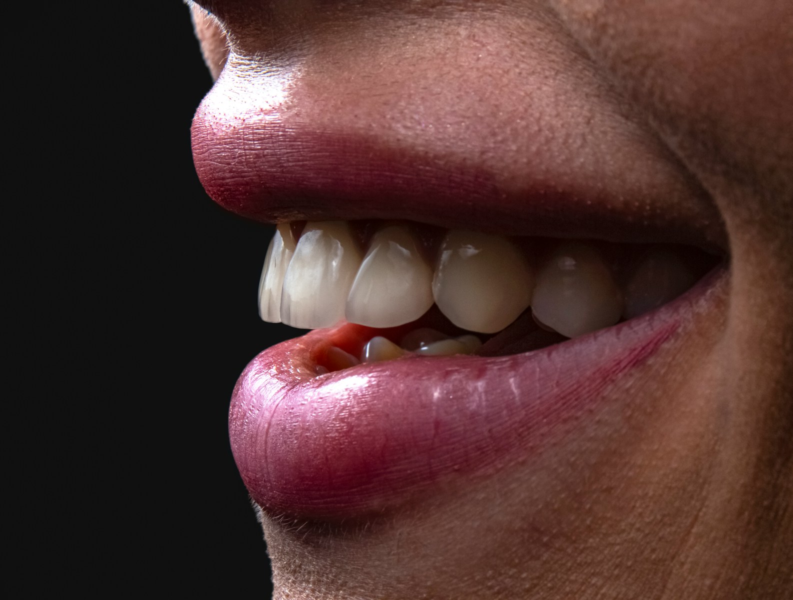 How Preventive Dentistry Shapes The Success Of A Smile Makeover a person's mouth with teeth and tongue sticking out