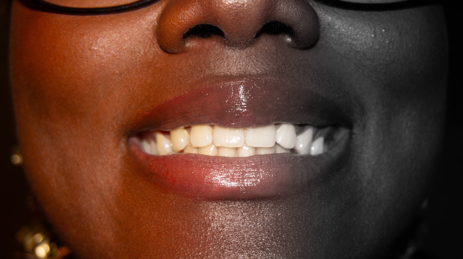6 Benefits Of Choosing A Family Dentist Who Offers Cosmetic Services Close-up of a woman's mouth with teeth showing