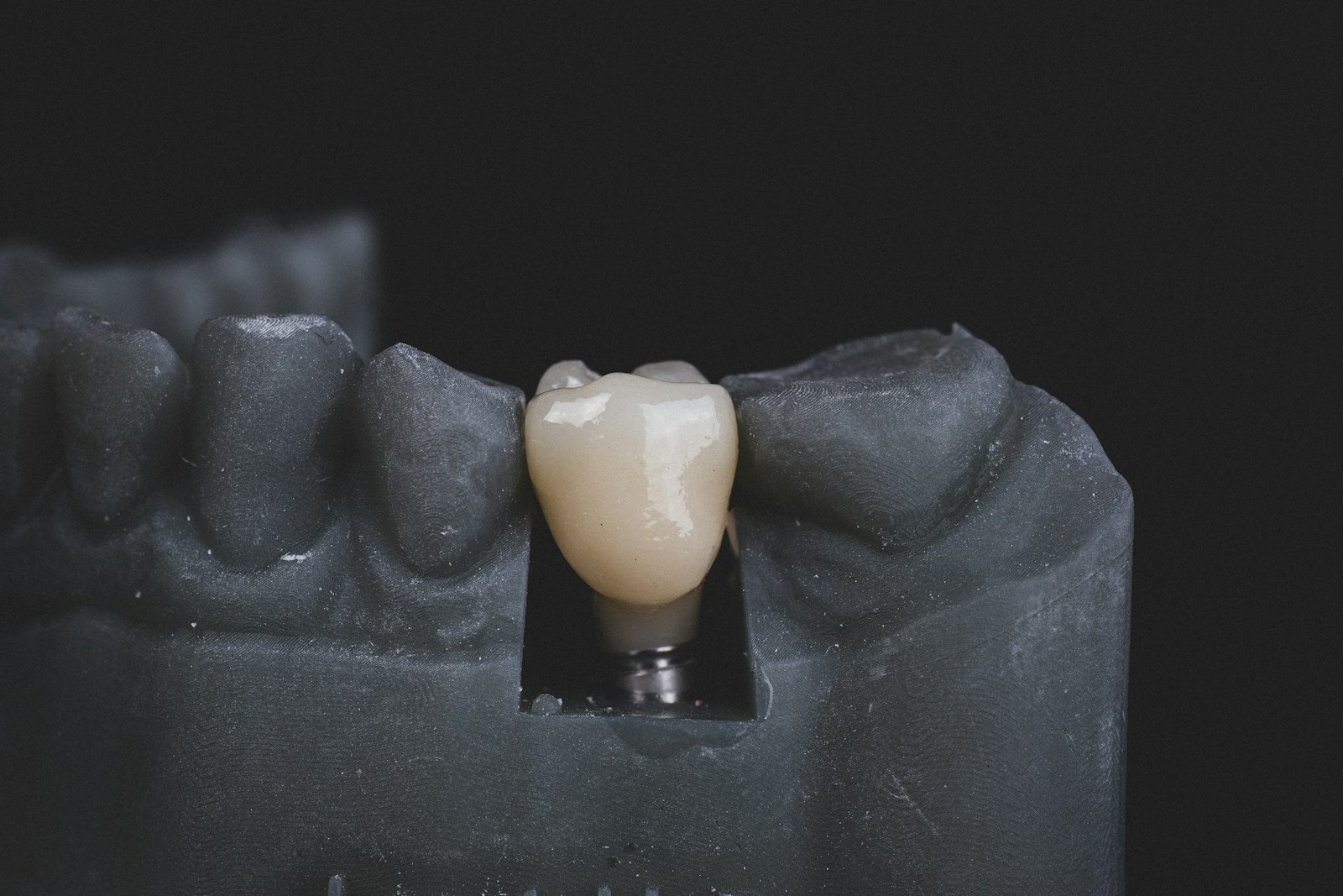 3 Key Advantages Of Choosing Implants Over Removable Dentures white candle on black textile