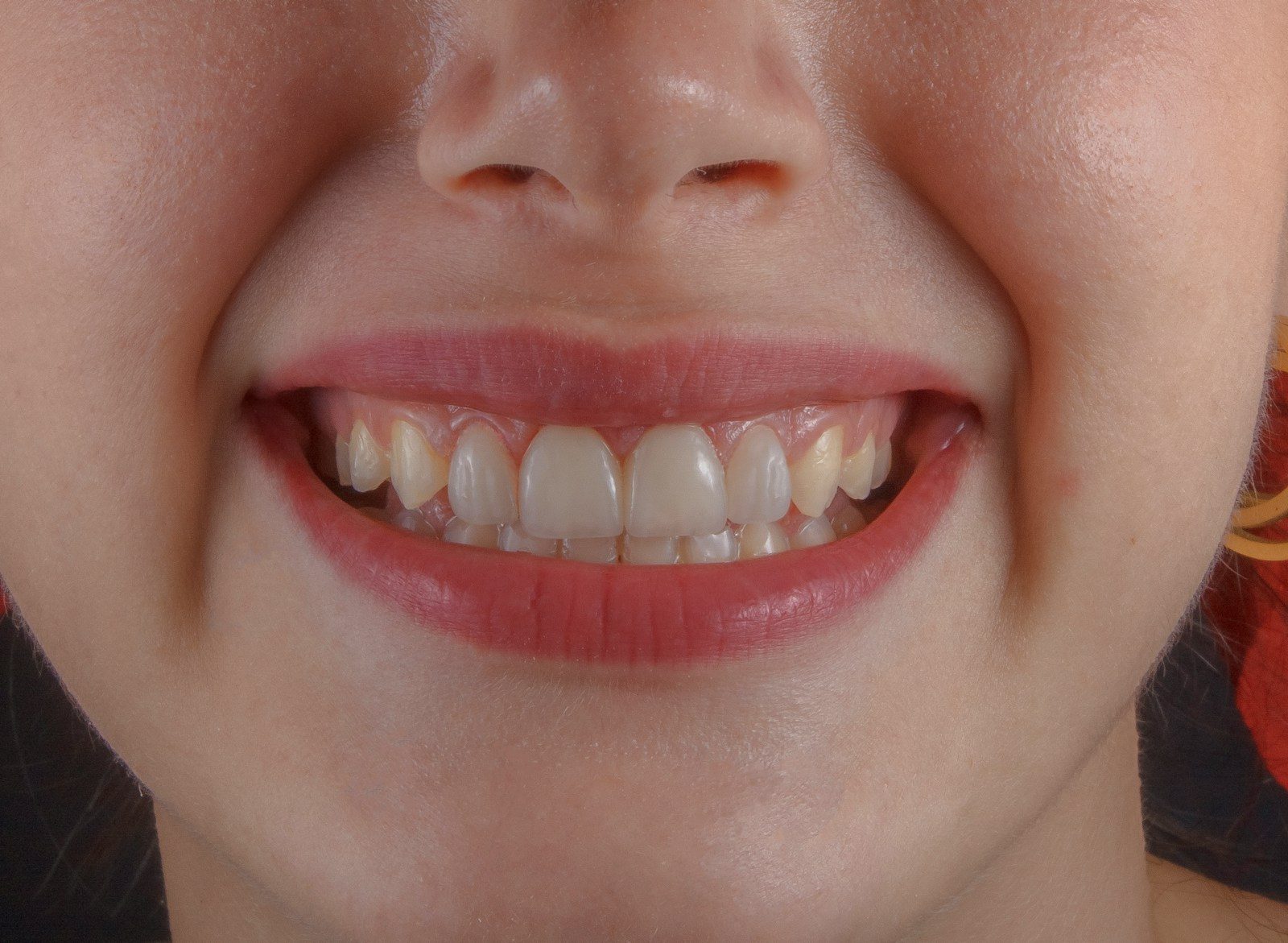 The Role Of Family Dentistry In Making Cosmetic Services Accessible a close up of a person's mouth